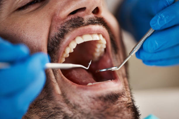 Best Broken Tooth Emergency  in Rock Valley, IA